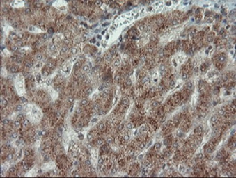 Anti-Melanoma gp100 antibody [8A4] used in IHC (Paraffin sections) (IHC-P). GTX83640