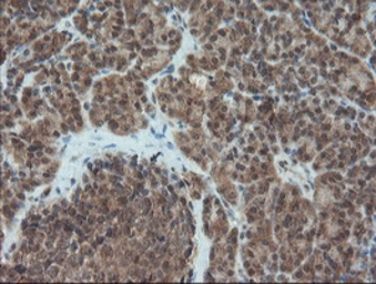 Anti-Melanoma gp100 antibody [8A4] used in IHC (Paraffin sections) (IHC-P). GTX83640