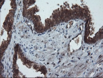 Anti-Melanoma gp100 antibody [8A4] used in IHC (Paraffin sections) (IHC-P). GTX83640