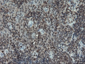 Anti-Melanoma gp100 antibody [8A4] used in IHC (Paraffin sections) (IHC-P). GTX83640