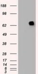 Anti-Melanoma gp100 antibody [8A4] used in Western Blot (WB). GTX83640