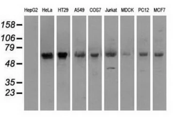 Anti-Melanoma gp100 antibody [8A4] used in Western Blot (WB). GTX83640
