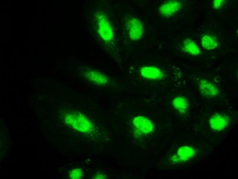 Anti-Melanoma gp100 antibody [8A4] used in Immunocytochemistry/ Immunofluorescence (ICC/IF). GTX83640