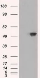 Anti-SIL1 antibody [1F9] used in Western Blot (WB). GTX83645