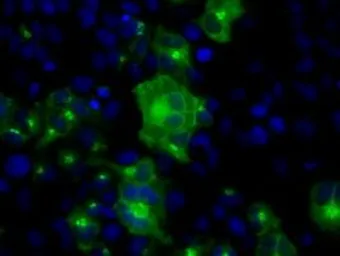 Anti-SIL1 antibody [1F9] used in Immunocytochemistry/ Immunofluorescence (ICC/IF). GTX83645