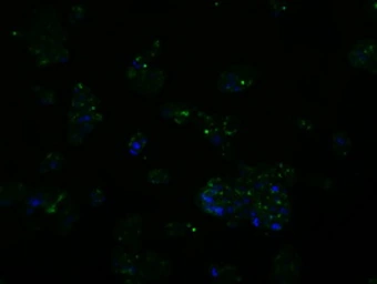 Anti-SIL1 antibody [1F9] used in Immunocytochemistry/ Immunofluorescence (ICC/IF). GTX83645