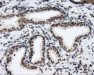 Anti-SHC1 antibody [3A1] used in IHC (Paraffin sections) (IHC-P). GTX83656