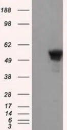 Anti-SHC1 antibody [3A1] used in Western Blot (WB). GTX83656