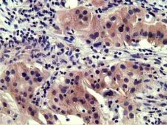 Anti-SH3GL1 antibody [2F5] used in IHC (Paraffin sections) (IHC-P). GTX83657