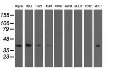 Anti-SH3GL1 antibody [2F5] used in Western Blot (WB). GTX83657