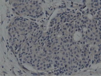 Anti-SH3GL1 antibody [3F8] used in IHC (Paraffin sections) (IHC-P). GTX83658