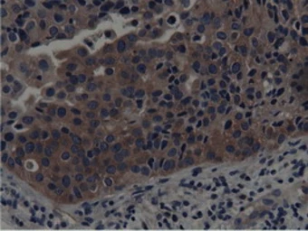 Anti-SH3GL1 antibody [3F8] used in IHC (Paraffin sections) (IHC-P). GTX83658
