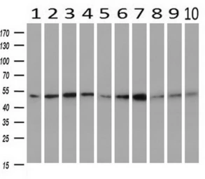 Anti-Antithrombin III antibody [8D5] used in Western Blot (WB). GTX83659