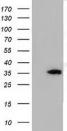 Anti-SDR9C7 antibody [6A8] used in Western Blot (WB). GTX83673