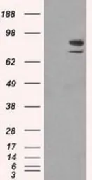 Anti-SATB1 antibody [11E8] used in Western Blot (WB). GTX83679