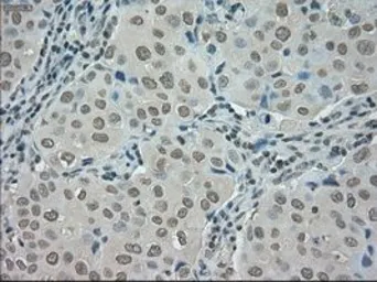 Anti-SATB1 antibody [13D6] used in IHC (Paraffin sections) (IHC-P). GTX83682