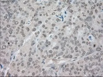 Anti-SATB1 antibody [13D6] used in IHC (Paraffin sections) (IHC-P). GTX83682