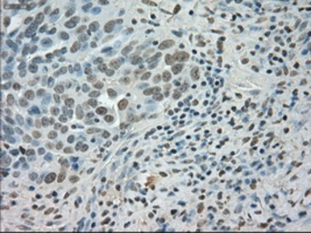 Anti-SATB1 antibody [13D6] used in IHC (Paraffin sections) (IHC-P). GTX83682