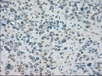 Anti-SATB1 antibody [13D6] used in IHC (Paraffin sections) (IHC-P). GTX83682