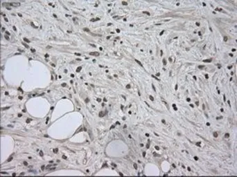 Anti-SATB1 antibody [13D6] used in IHC (Paraffin sections) (IHC-P). GTX83682