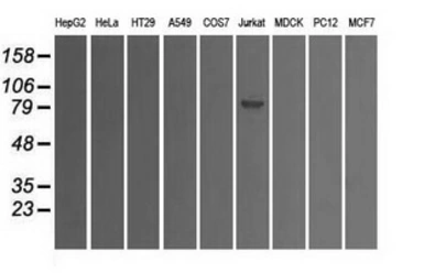 Anti-SATB1 antibody [13D6] used in Western Blot (WB). GTX83682