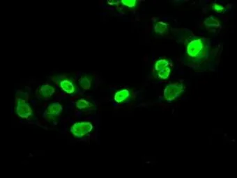Anti-SATB1 antibody [13D6] used in Immunocytochemistry/ Immunofluorescence (ICC/IF). GTX83682