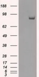 Anti-SATB1 antibody [6C6] used in Western Blot (WB). GTX83685