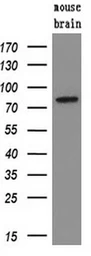 Anti-SAMHD1 antibody [1F9] used in Western Blot (WB). GTX83686