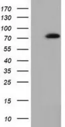 Anti-SAMHD1 antibody [1F9] used in Western Blot (WB). GTX83686
