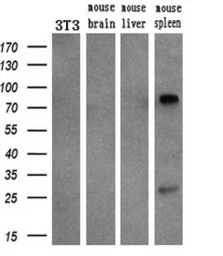 Anti-SAMHD1 antibody [1F6] used in Western Blot (WB). GTX83687