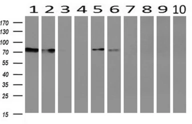 Anti-SAMHD1 antibody [1F6] used in Western Blot (WB). GTX83687