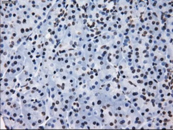 Anti-RPA32 antibody [8B3] used in IHC (Paraffin sections) (IHC-P). GTX83688