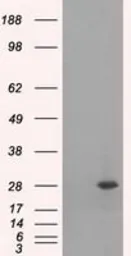 Anti-RPA32 antibody [8B3] used in Western Blot (WB). GTX83688