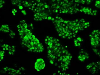 Anti-RPA32 antibody [8B3] used in Immunocytochemistry/ Immunofluorescence (ICC/IF). GTX83688