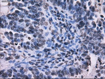Anti-RPA32 antibody [1H10] used in IHC (Paraffin sections) (IHC-P). GTX83691