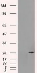 Anti-RPA32 antibody [1H10] used in Western Blot (WB). GTX83691