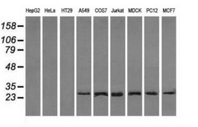 Anti-RPA32 antibody [1H10] used in Western Blot (WB). GTX83691