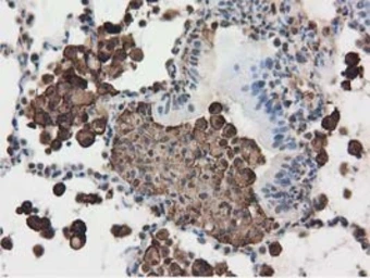 Anti-Ribonuclease Inhibitor antibody [3F11] used in IHC (Paraffin sections) (IHC-P). GTX83696
