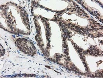 Anti-Ribonuclease Inhibitor antibody [3F11] used in IHC (Paraffin sections) (IHC-P). GTX83696