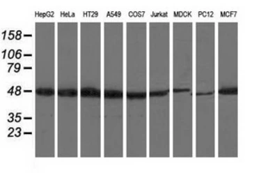 Anti-Ribonuclease Inhibitor antibody [3F11] used in Western Blot (WB). GTX83696