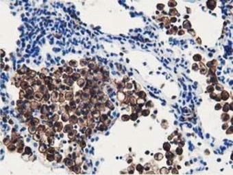 Anti-Ribonuclease Inhibitor antibody [4G4] used in IHC (Paraffin sections) (IHC-P). GTX83697