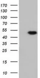 Anti-Ribonuclease Inhibitor antibody [4G4] used in Western Blot (WB). GTX83697