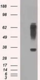 Anti-RNF144B antibody [9H10] used in Western Blot (WB). GTX83704