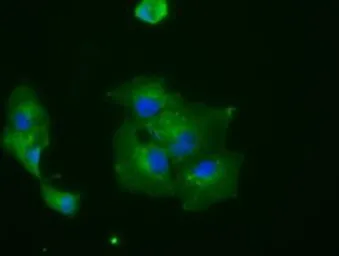 Anti-RNF144B antibody [9H10] used in Immunocytochemistry/ Immunofluorescence (ICC/IF). GTX83704