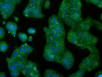 Anti-RNF144B antibody [9H10] used in Immunocytochemistry/ Immunofluorescence (ICC/IF). GTX83704