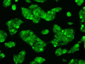 Anti-RNF144B antibody [11F4] used in Immunocytochemistry/ Immunofluorescence (ICC/IF). GTX83705