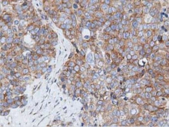 Anti-RIT2 antibody [3F4] used in IHC (Paraffin sections) (IHC-P). GTX83710