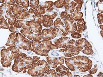 Anti-RIT2 antibody [3F4] used in IHC (Paraffin sections) (IHC-P). GTX83710