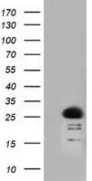 Anti-RIT2 antibody [3F4] used in Western Blot (WB). GTX83710