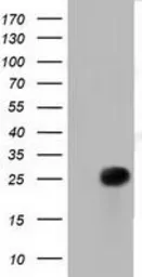 Anti-RIT2 antibody [4B5] used in Western Blot (WB). GTX83711